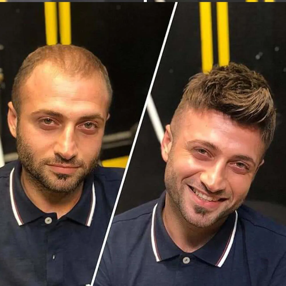 toupee33