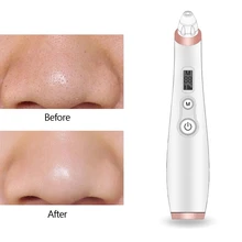 Вакуумный Очиститель пор уход за кожей лица набор косметических средств акне для удаления, всасывающий Черный инструмент для очистки пор для чистки лица косметологии уход за кожей лица машина