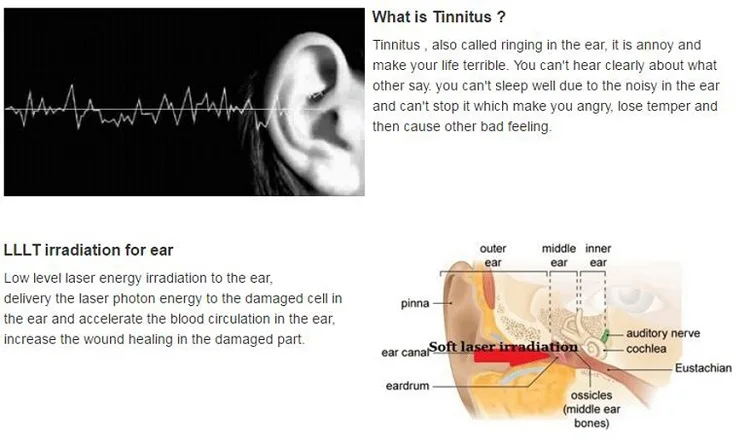 Популярные домашнего использования LASPOT устройства лечить отит/шум в ушах низкоинтенсивной лазерной терапии активной защиты слуха