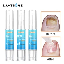 3 шт. травяной носок Лечение грибка/Onychomycosis Paronychia/противогрибковые инфекция ногтей дезинфекция ремонт масло для ногтей ручка