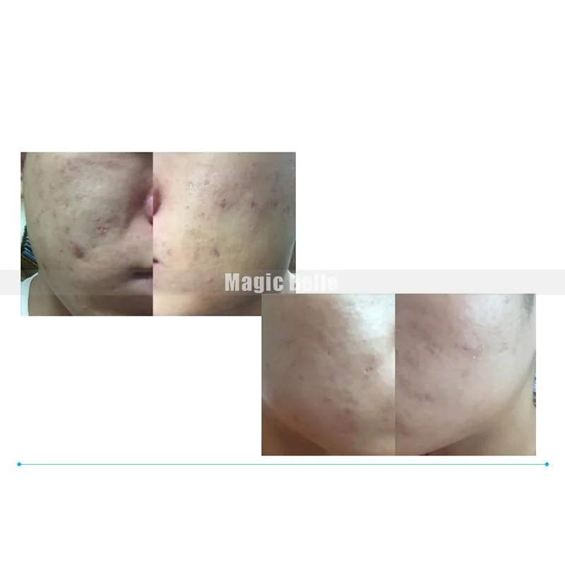 Plasma OG MA (3)