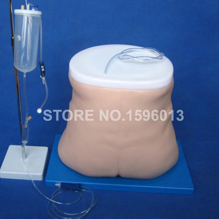 F1 Peritoneal dialysis  (4)