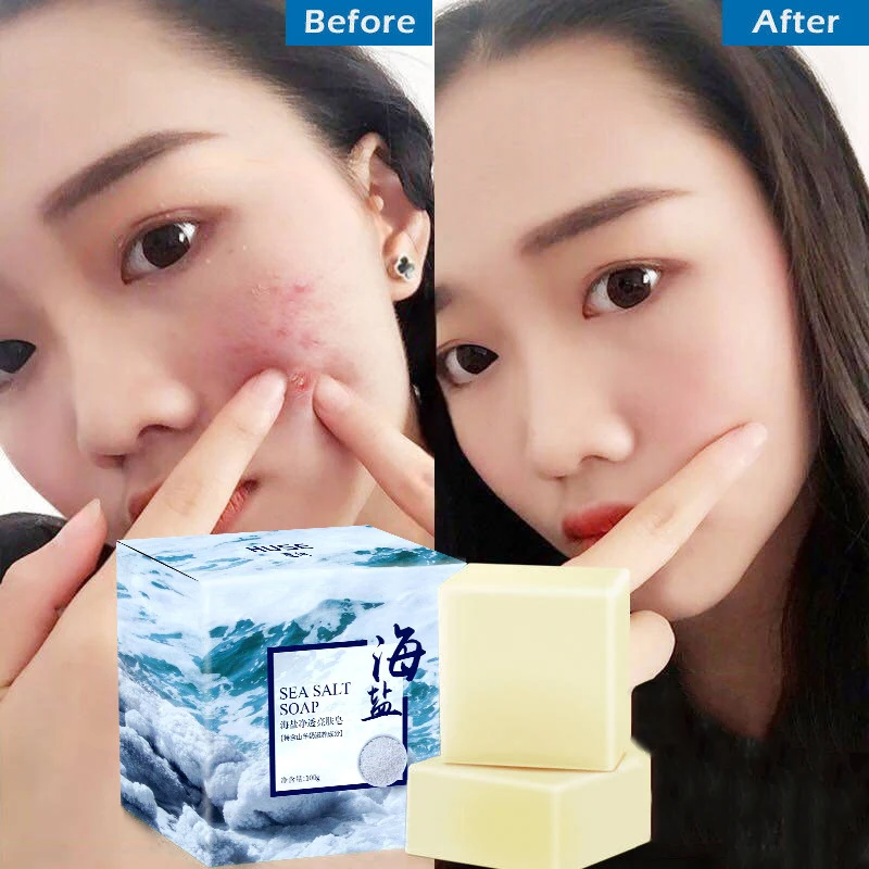 2019 Sea мыло с солью прыщи, акне лечения козьей увлажняющее молочко чистка лица мыло