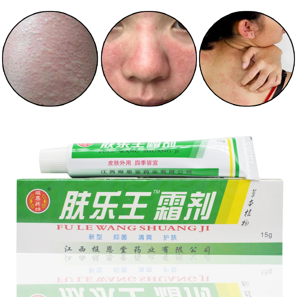 5Pcs Chinese Herbal Skin Topical Antipruritic Ointment Cream Analgesic Balm Ointment Psoriasis Cream Body Massage Cream D059
5Pcs Chinese Herbal Skin Topical Antipruritic Ointment Cream Analgesic Balm Ointment Psoriasis Cream Body Massage Cream D059