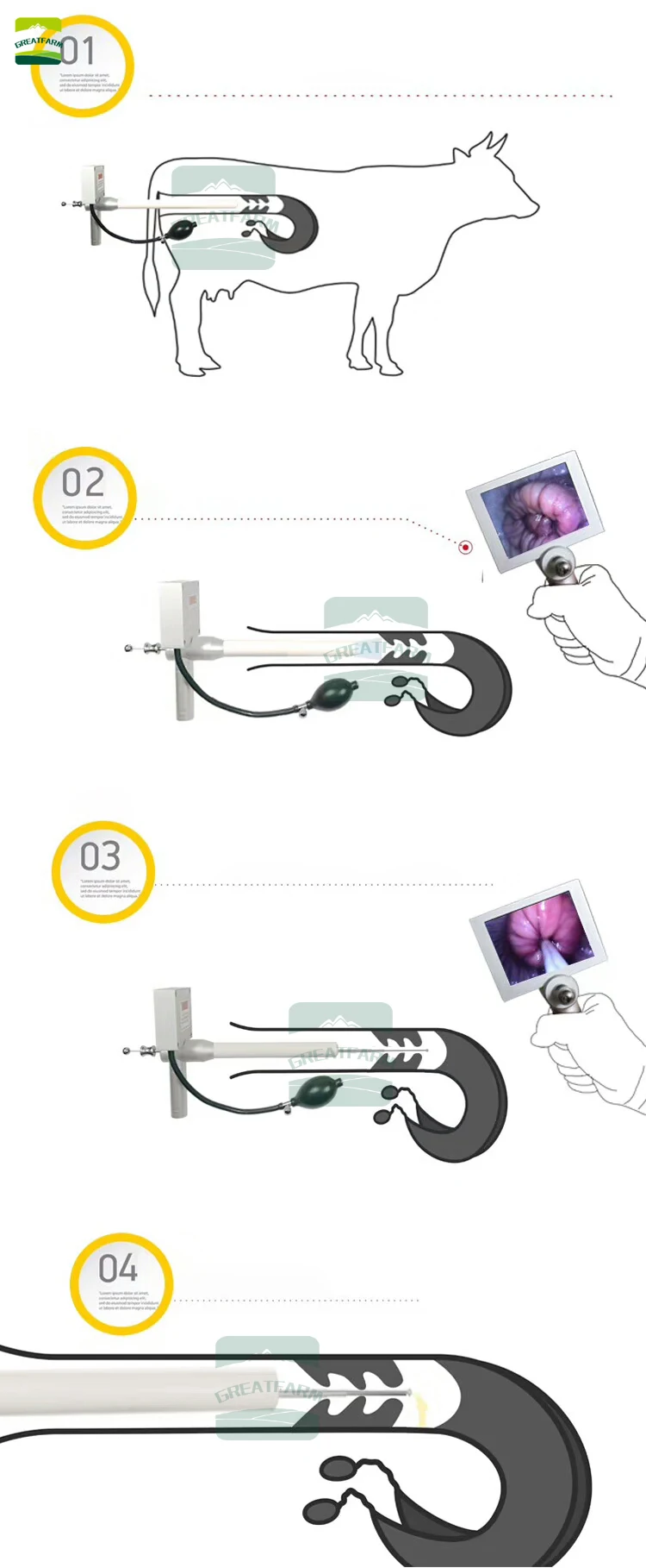 x1