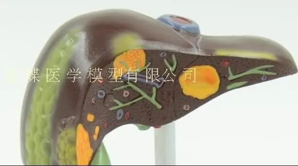 QQ20180622185435