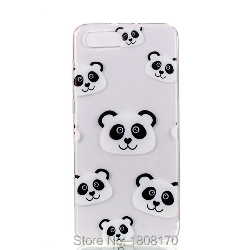 71198 V10 MATE10 LITE P20LITE 9LITE 6X NOKIA 1  NOKIA 7PLUS TPU (7)
