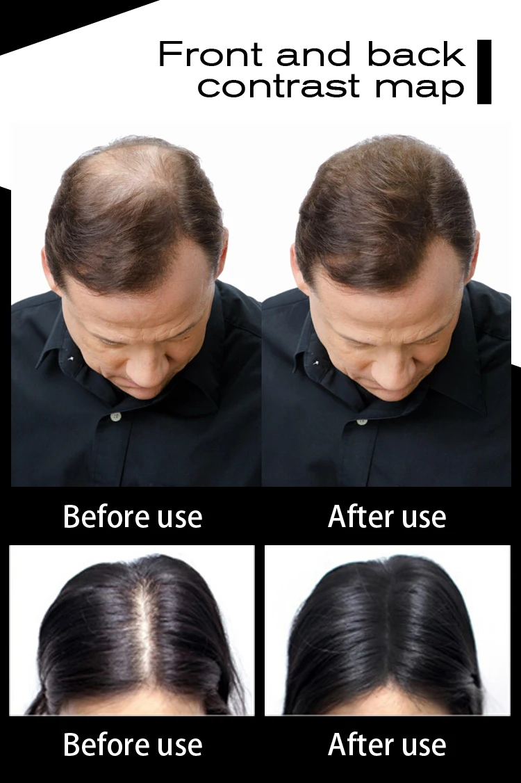 Новые 27,5 г наращивания волос волокон кератин толще от выпадения волос продукты восполняемый консилер утолщение волокна порошки роста