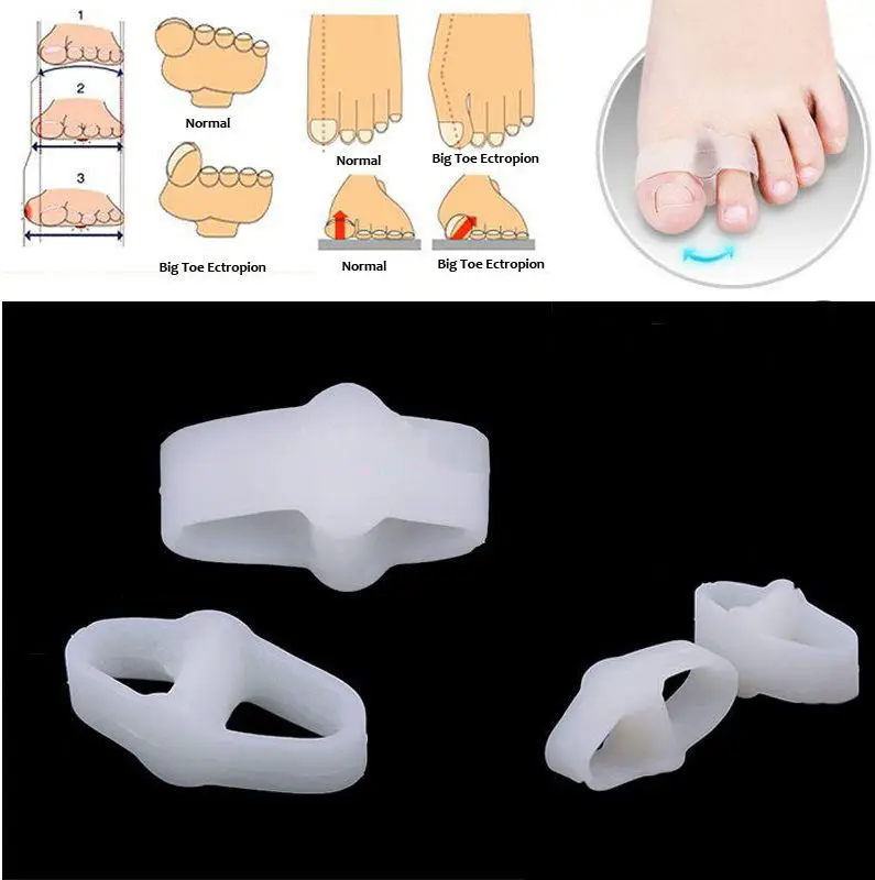 

1 Pair Of Toe Separators Stretchers Straighteners Alignment Bunion Gel 2 Holes Pain Relief Foot Care Tools