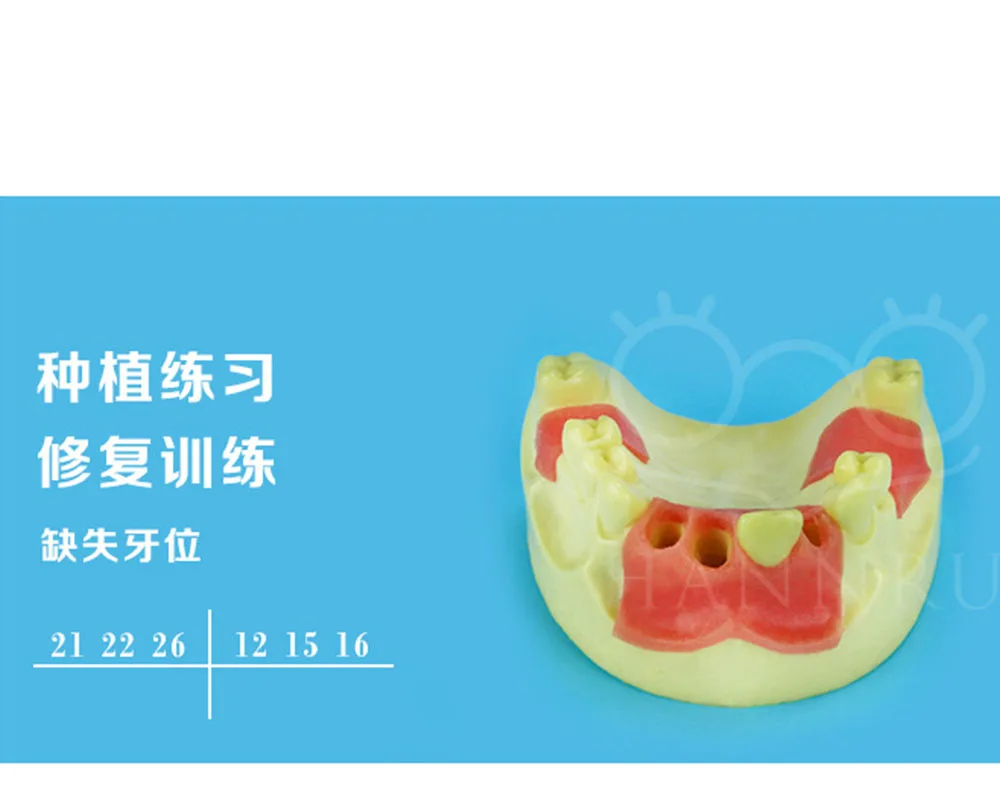 Оральная модель, maxillary anterior отсутствует для тренировки имплантации модели, модель зубного импланта