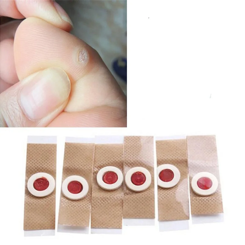 

36pcs Foot Corn Killer Calluses Plantar Warts Thorn Pain Relief Plaster Foot Care Tool Medical Sticker Toe Protector