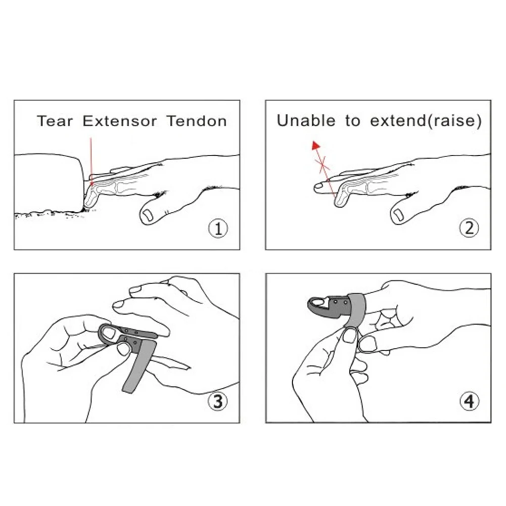Инструмент для ухода за артритом корректор давления массажный выпрямитель для пальцев пальцевая шина фиксатор для перелома кончик пальца защитный рукав