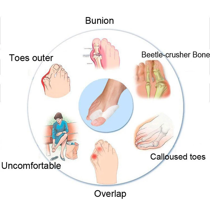 Toe Separators Finger Gel Stretchers Bunion Protector Straightener Corrector Without Box Bone Thumb Pedicure Device Foot Care Toe Separators Finger Gel Stretchers Bunion Protector Straightener Corrector Without Box Bone Thumb Pedicure Device Foot Care