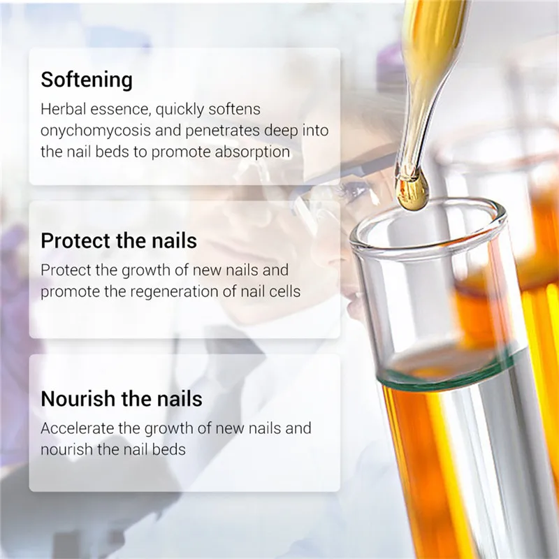 nail repair essence Serum fungal nail treatment remove onychomycosis nail nail nourishing Brighten Care of hands