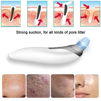 

ABS Skin Care Massage Professional Electronic Facial Pore Cleaner Nose Blackhead Cleansing Acne Remover Comedo Suction Tools