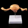 Medical props model Human Pathological Uterus Ovary Model Anatomical Anatomy Disease Pathology Medical Lesion For Teaching ► Photo 3/6