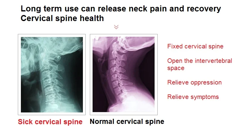 Подвеска на дверь, Шейная Тяговая рама, подвесная тяга на шею, для дома, лечение шейного спондилеза, натяжитель боли в шее