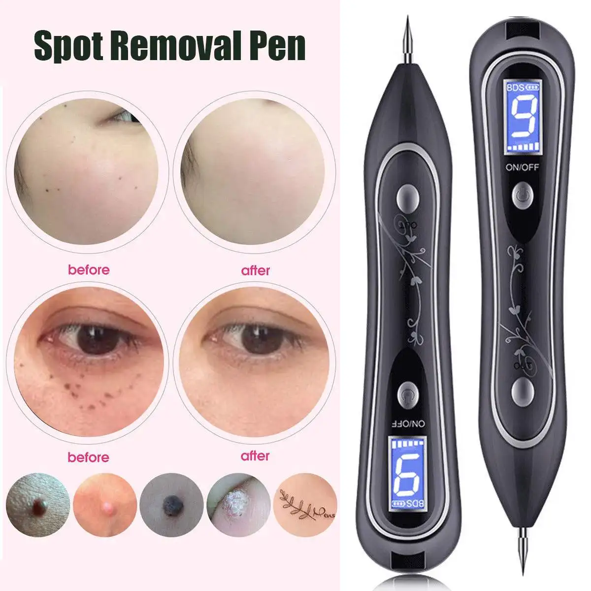 

9 Levels Electric Laser Freckle Dark Spot Removal Pen Machine Facial Body Skin Mole Wart Tag Blemish Removal Beauty Care Device