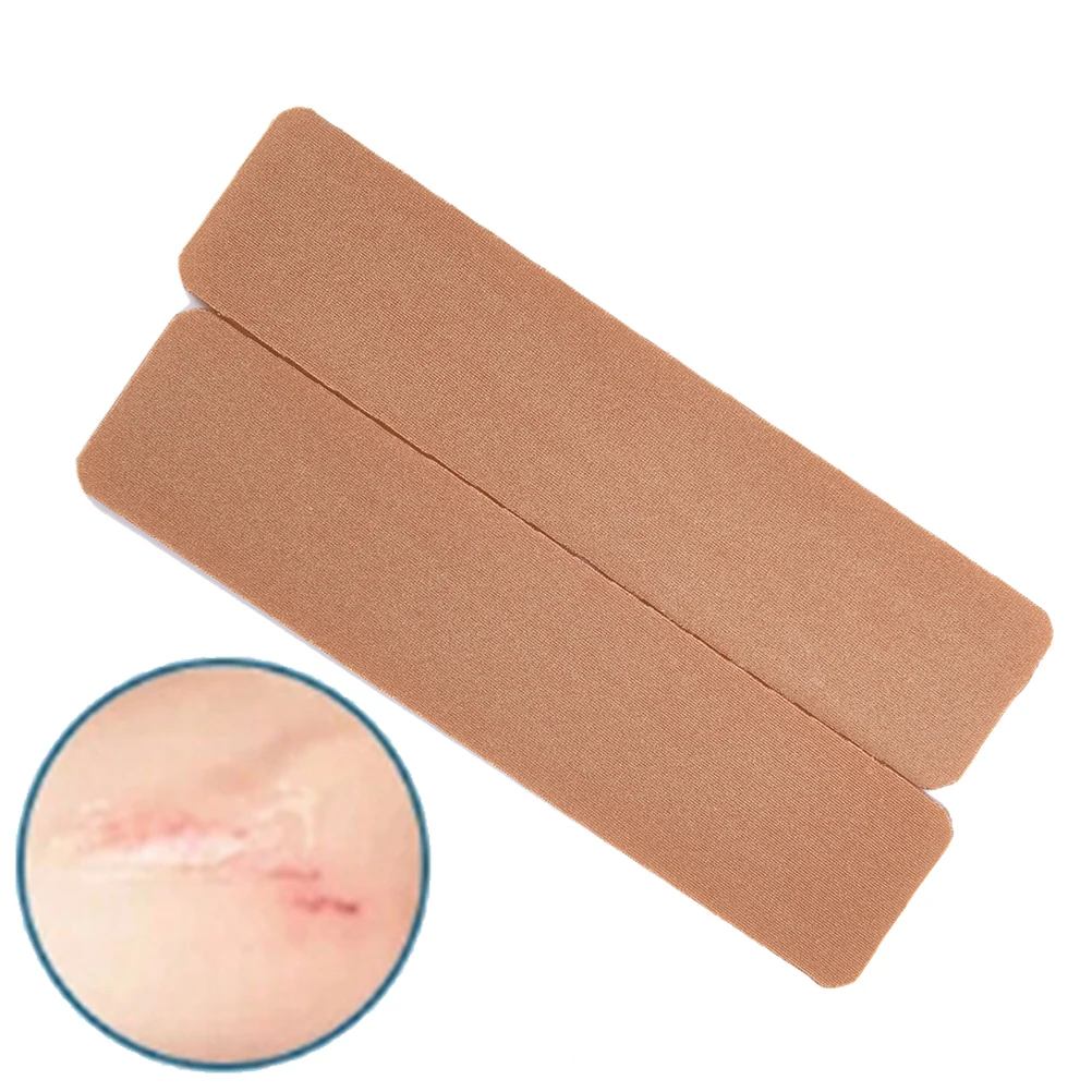 2 шт силиконовый пластырь для удаления шрамов гель от угрей терапия силиконовый пластырь удаление цезарева травма ожога лист ремонт кожи 15 см x 3,5 см