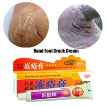 Крем для ног против трещин на пятках, крем для ухода за кожей ног и рук, китайская мазь против трещин, Новинка
