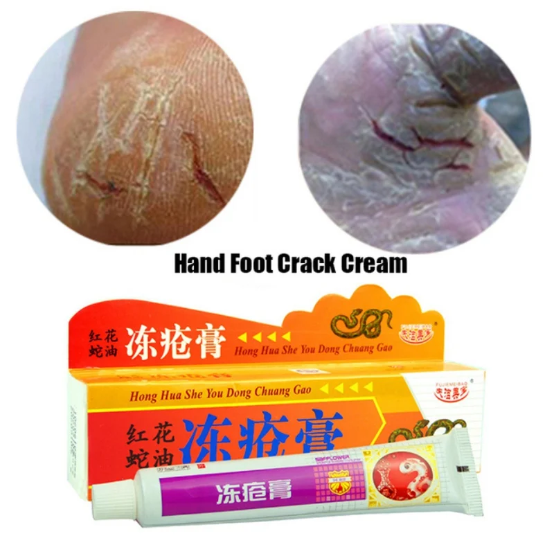 

Foot cream for cracked heels Anti Crack Foot and hand care cream skin care Chinese Ointment Anti chapping new