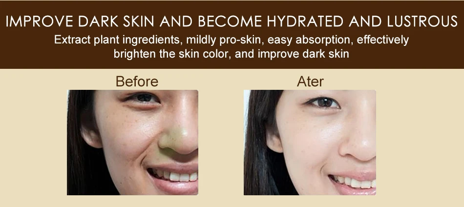 Snail Moisturizing Face Cream Remove Age Spot Scar Pigment Whitening Anti Wrinkle Cream Beauty Miracle Glow Day& Night Cream