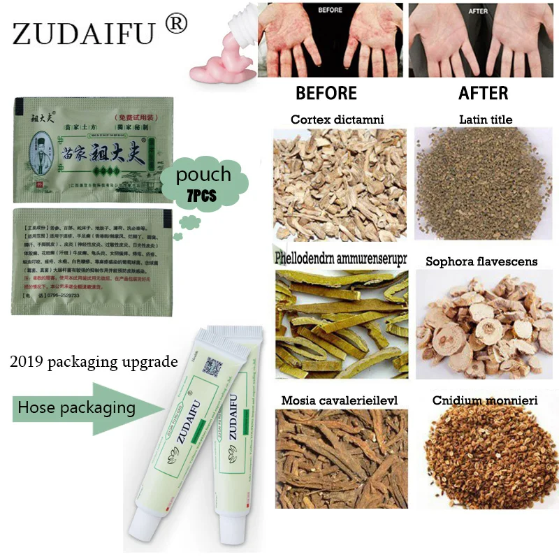 7 шт./лот,, ZUDAIFU псориаз, дерматит, Eczema Pruritus, проблемы с кожей, крем, мешочек, такой же эффект, как тюбик