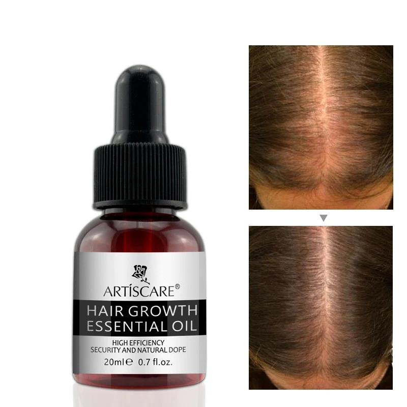 Hair Growth Essential Oil Anti Hair Loss Liquid Hair Repair Treatment Dense for Women Men Regrowth Hair Care Serum