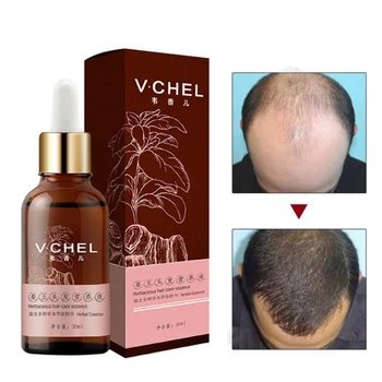 

New 7 Days Hair Growth Essential oil 30ml Hairs Care Oil Ginger Essence Hairdressing Anti-hair Loss Dry Damaged Hair Nutrition