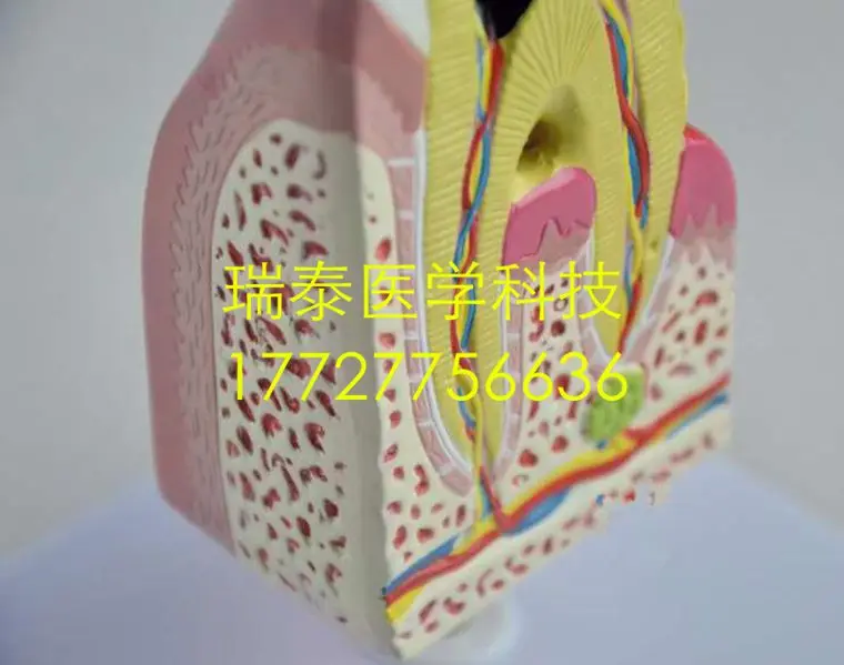 12*11*20 см медицинская научная зубная модель патологические зубы стоматологические кариес зубная Дека полости рта учебная форма
