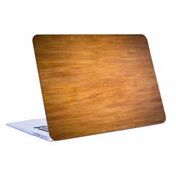 

Marble Pattern printing Hard Cover Case +Silicone Keyboard Cover For Apple Macbook Pro 13 without Touch Bar Model :A1988 A1708