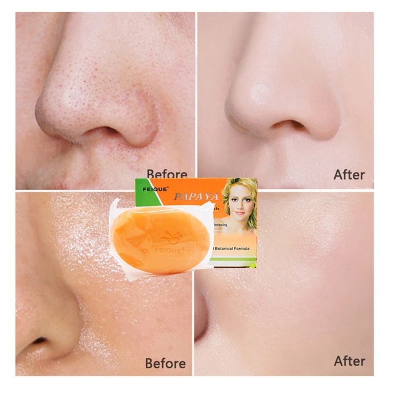 130g per pcs Feique All-natural Botanical Formula Papaya Whitening Anti-freckle Renewing Soap Face Skin Care Product 130g per pcs Feique All-natural Botanical Formula Papaya Whitening Anti-freckle Renewing Soap Face Skin Care Product