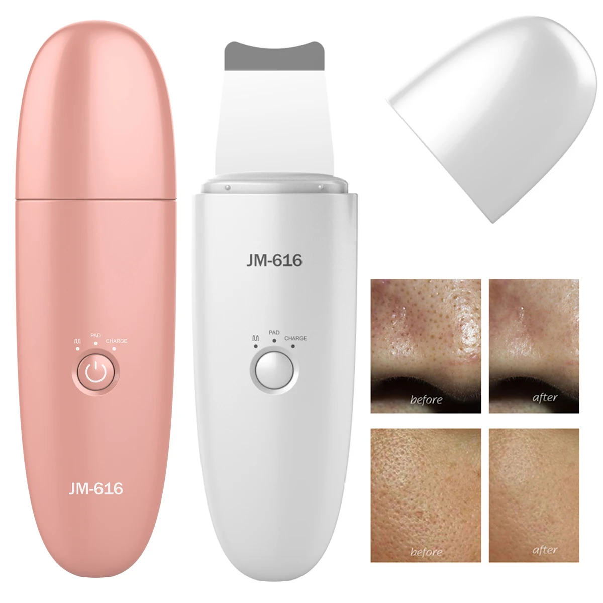 

Ultrasonic Skin Scrubber SPA Gentle Blackhead Remover Comedones Extractor Deep Cleaning Face Pore Facial Cleaner Skin Care