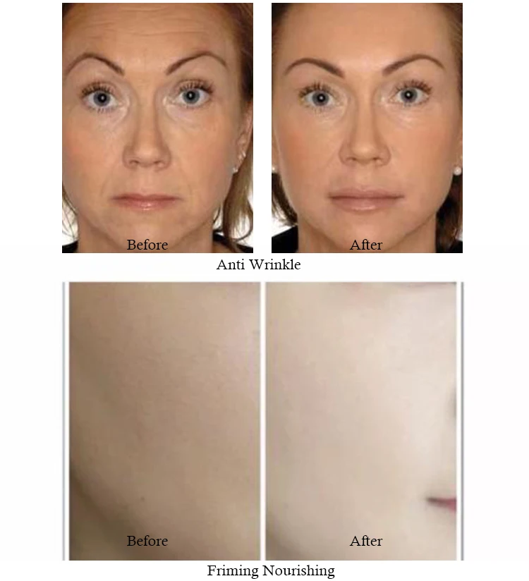 Retinol Cream (81)