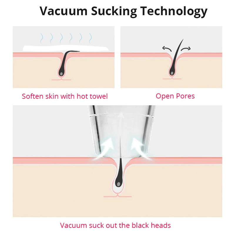 Skup Wielofunkcyjny elektryczny oczyszczacz do wągrów głębokie czyszczenie porów do ujędrniania skóry kontrola oleju 3 głowice ssące Vacuun 2 AA moc baterii