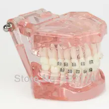 Halfmetal halfcemeric Ортодонтия модель зубной зубы стоматолог стоматология odontologia Tyodont модель