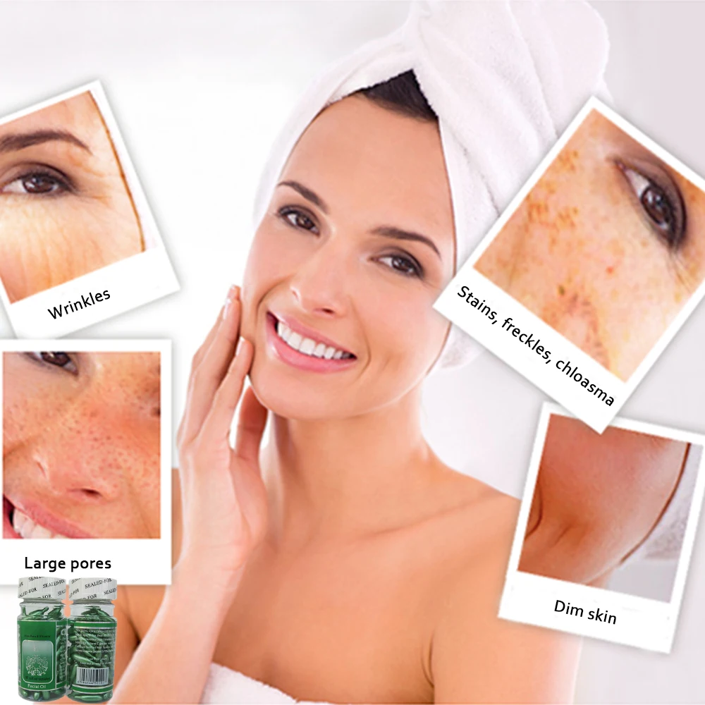 

skin care Acne Pimples essence, avocado oil protein hormone,balance sebum secretion, Vitamin E capsule