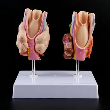 

Human Thyroid Anatomical Pathology Model Normal and Disease Pathologies Medical Teaching Resource Tool