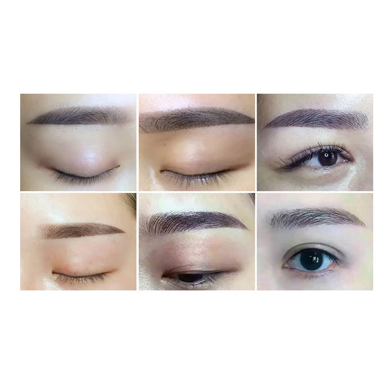 2rows15needles-5