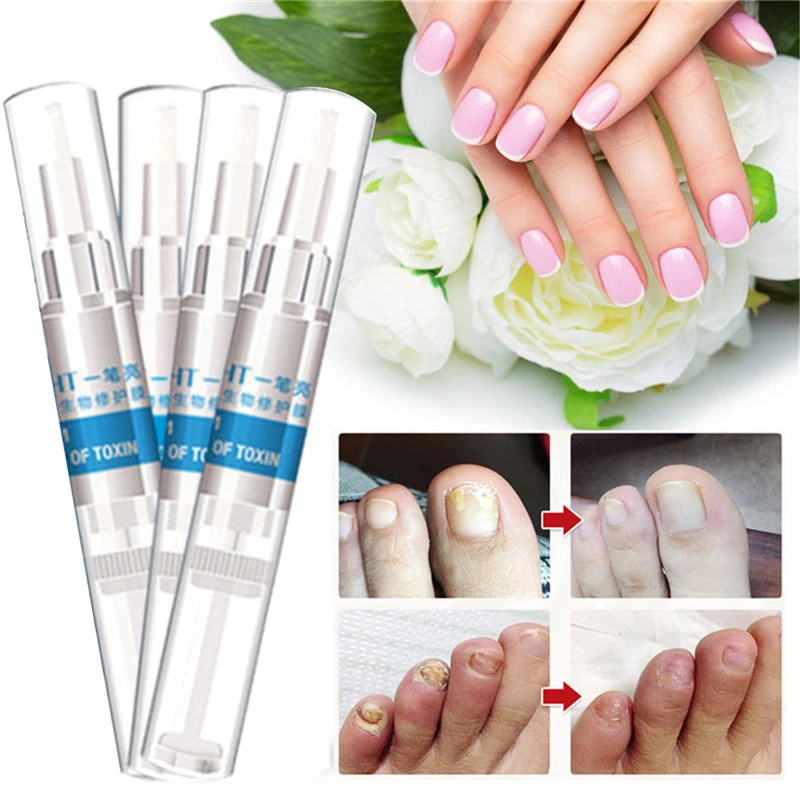 4pcs Nail Treatment Pen Infection Nail Bright Pencil Fungal Treatment Anti Fungus Biological Repair 3ml Restores Healthy Nails Aliexpress