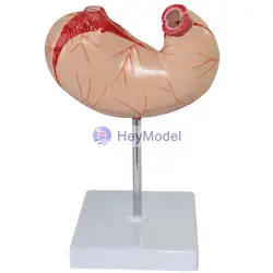 Heymodel желудок анатомия модель 2 Запчасти