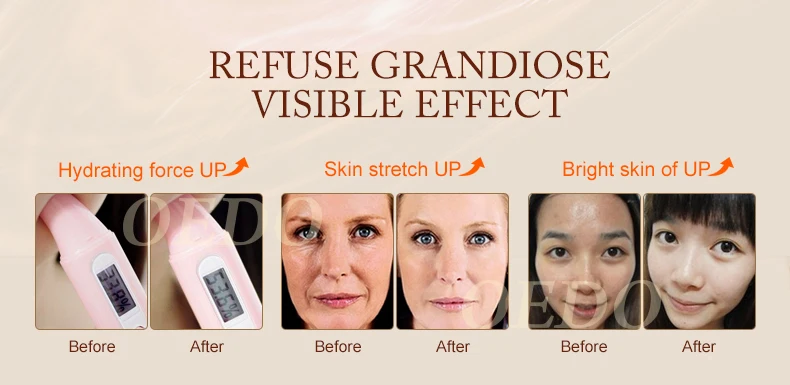 Oedo Argireline яркости и Anti-aging шелковистая маска для лица 2 шт./лот отбеливание; против старения сужает поры антивозрастной против морщин уход за кожей