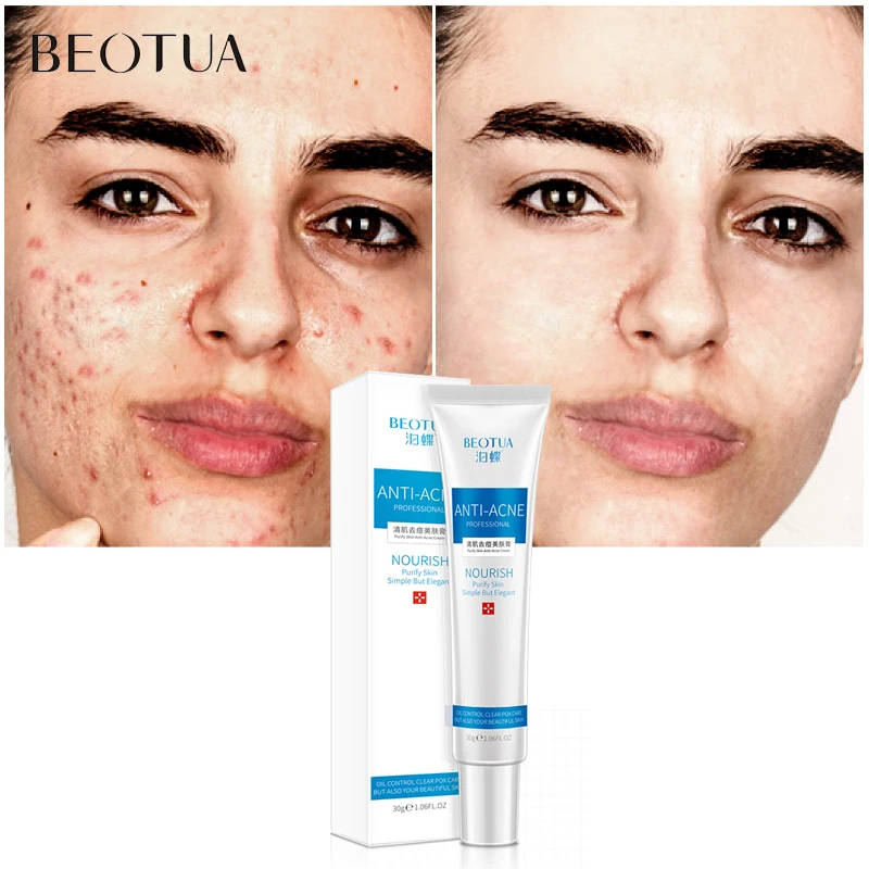 Крем для лица BEOTUA Tea Tree антиакне лечение акне сужение пор коллагеновое удаление
