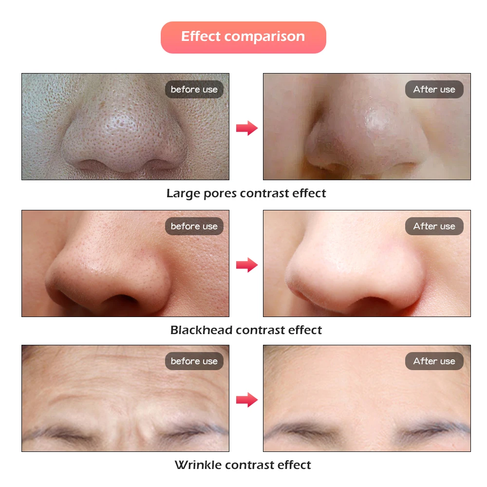  7 Colors Light LED Facial Mask With Neck Skin Rejuvenation Face Care Treatment Beauty Anti Acne The - 33026291237