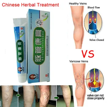 

1boxes Chinese natural herbal medicine for treating varicose vascular inflammation massage cream cure varicose vein ointment