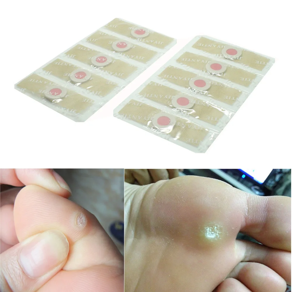 12 pcs /Only $0.75 Detox Foot Pads Patches Feet Care Corn Removal Remover Medical Plaster G08008 | Красота и здоровье