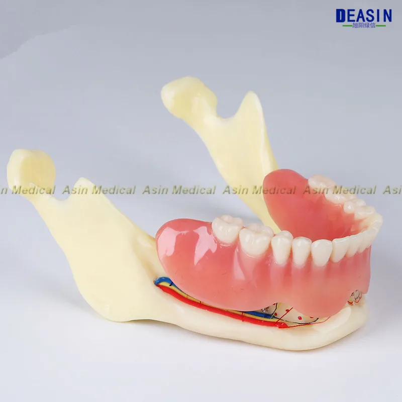 Высокое качество Смола Покрытие мандибулярных зубных протезов модель мандибль пояс модель нерва дисплей зубные протезы съемные зубы модель