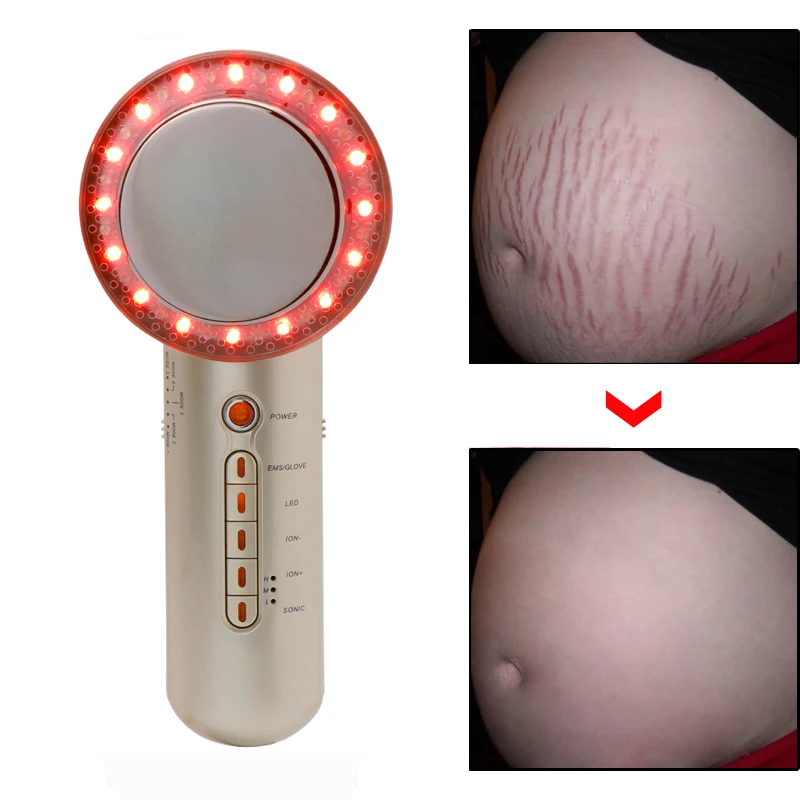 

6 IN 1 Ultrasound Cavitation EMS Body Slimming Massager Weight Loss Anti Cellulite Fat Burner Stretch Marks Remover Therapygold