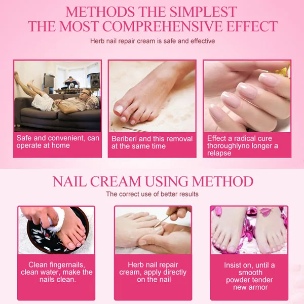 Nail Foot Protector Herbal Toe Nail Treatment Repair Cream Anti Fungal Infection Skin Care Nail Care Tools