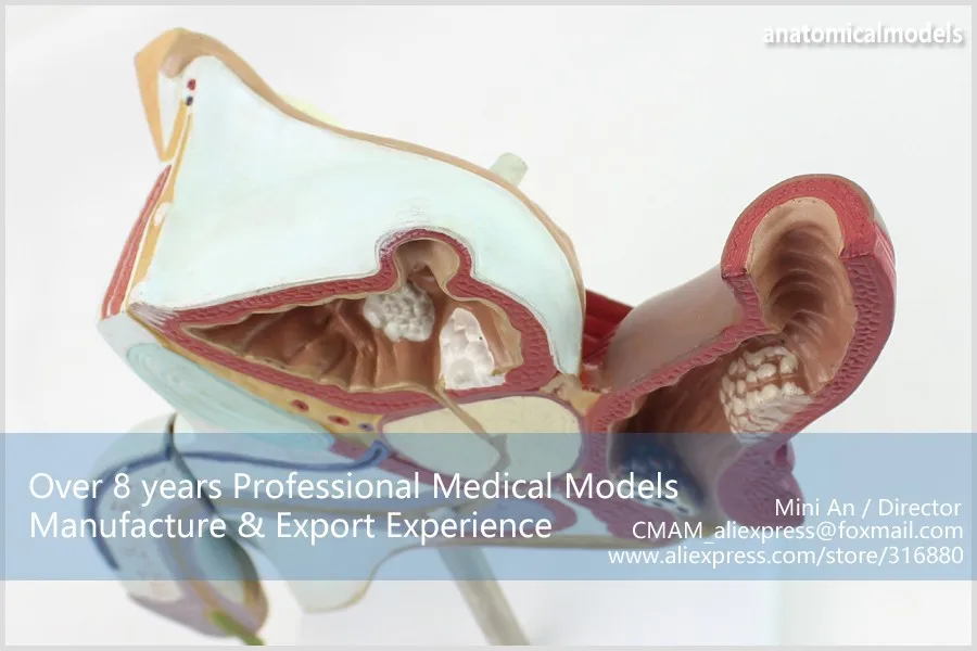 CMAM/12456 патологическая модель мужской урогенитальной системы, мочеполовое медицинское обучение анатомическая модель